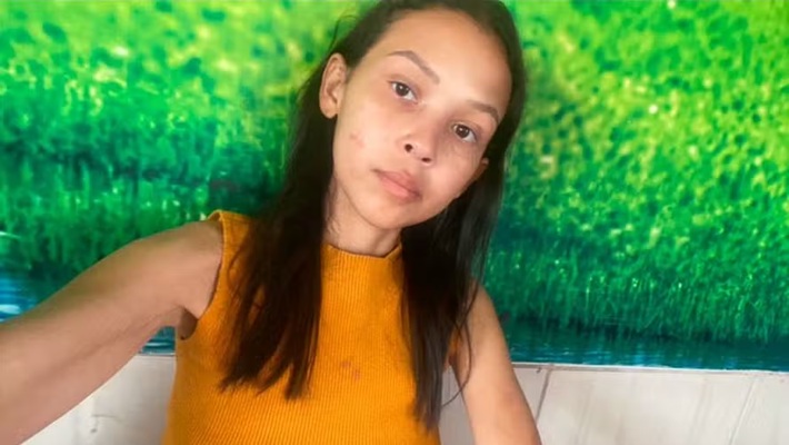 Necessidade de reversão de cirurgia bariátrica salva vida de mulher